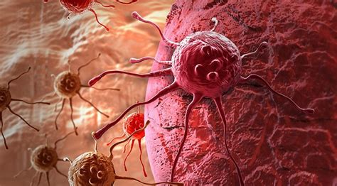 K­a­n­s­e­r­ ­t­e­d­a­v­i­s­i­n­d­e­ ­h­e­y­e­c­a­n­l­a­n­d­ı­r­a­n­ ­b­u­l­u­ş­ ­-­ ­S­a­ğ­l­ı­k­ ­H­a­b­e­r­l­e­r­i­